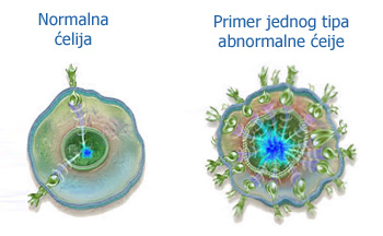 Primer normalne i kancerogene ćelije