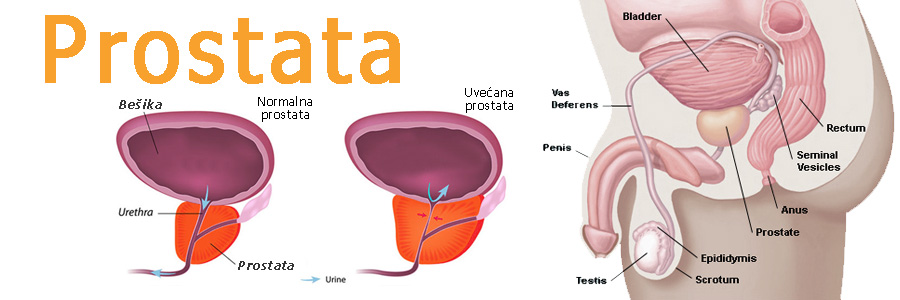 Rak prostate preti muškom delu populacije - Hormonski zavisni tumori (rajk dojke i prostate) pod direktnim su uticajem delovanja hormona estrogena.